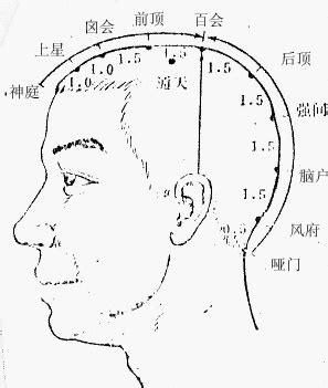 囪會穴|囟會穴位置 